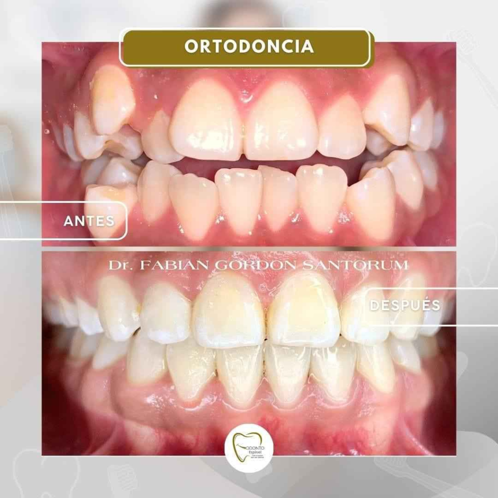 ortodoncia